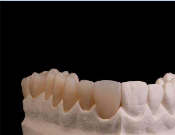 BSM Aconia TT-ML 3D Multilayer Zirconia - Image 4
